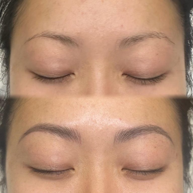 Close-up of closed eyes showing a before and after comparison; the top image shows sparse eyebrows, while the bottom image shows fuller, well-defined eyebrows.
