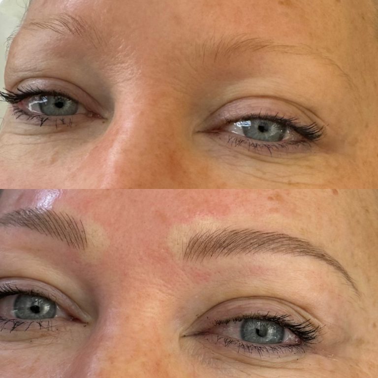 Top image shows a person with sparse eyebrows; bottom image shows the same person after eyebrow microblading, with fuller and more defined eyebrows.