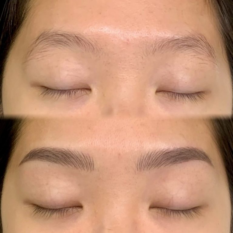 Close-up before and after image showing sparse eyebrows on top and fuller, defined eyebrows on the bottom, likely after a cosmetic procedure.