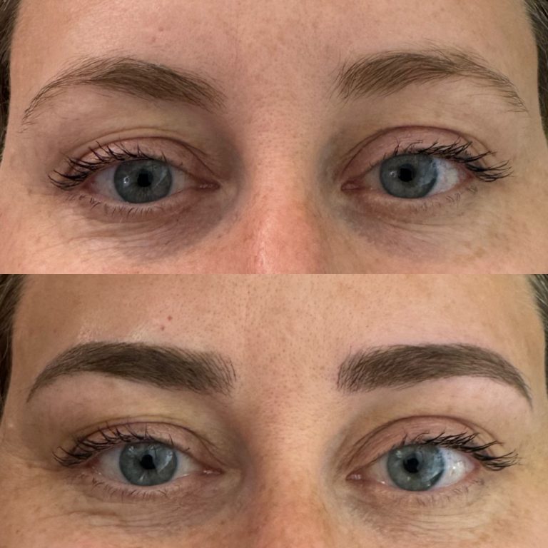 Close-up comparison of the same person's eyes and eyebrows before (top) and after (bottom) eyebrow enhancement or makeup application.