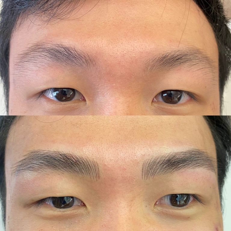 Close-up of a person's eyes showing a before (top) and after (bottom) comparison of eyebrow grooming or microblading.