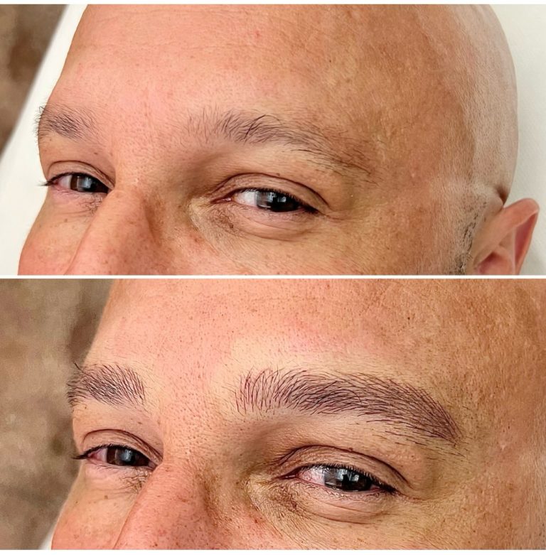 Close-up before-and-after images of a person's face showing sparse eyebrows in the top image and fuller, defined eyebrows in the bottom image.