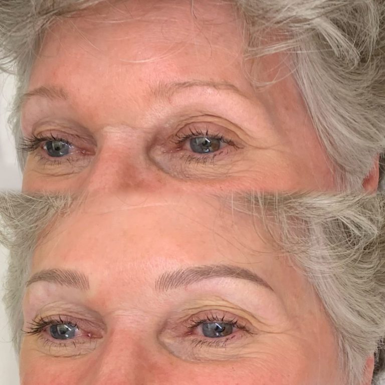 Close-up of a woman's eyes and eyebrows before (top) and after (bottom) cosmetic eyebrow enhancement, showing fuller and more defined eyebrows in the after image.