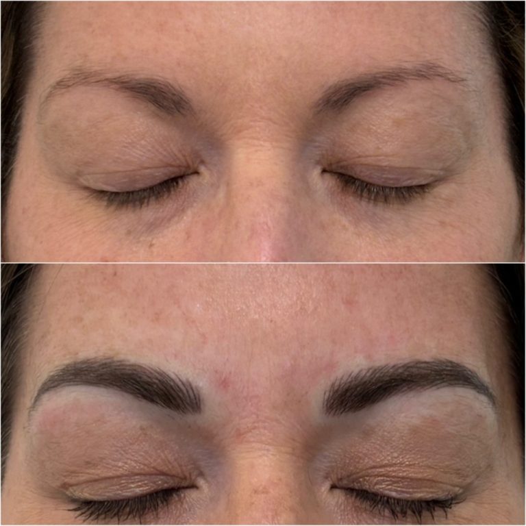 Close-up of a person's closed eyes before and after eyebrow enhancement; top image shows sparse brows, bottom image shows fuller, defined brows.