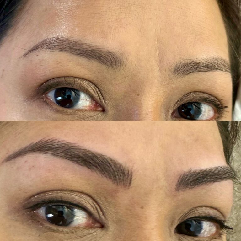 Close-up of a person's eyebrows before (top) and after (bottom) a cosmetic procedure, showing fuller and more defined brows in the after image.