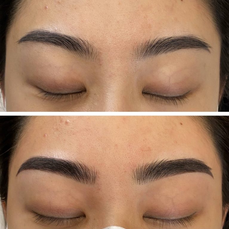 Close-up comparison of eyebrows before (top) and after (bottom) a cosmetic treatment, showing fuller and more defined brows in the after image.