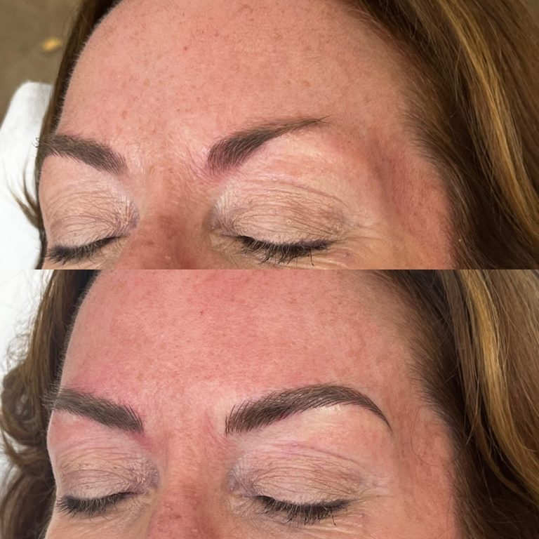 Before and after images showing a woman's eyebrows; the top image shows natural brows, while the bottom shows fuller, more defined brows after cosmetic treatment.