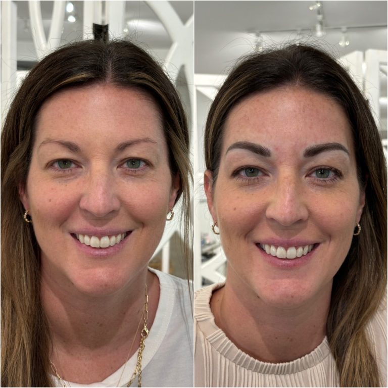 Side-by-side comparison of a woman before and after an eyebrow enhancement, showing fuller, more defined eyebrows in the after image on the right.