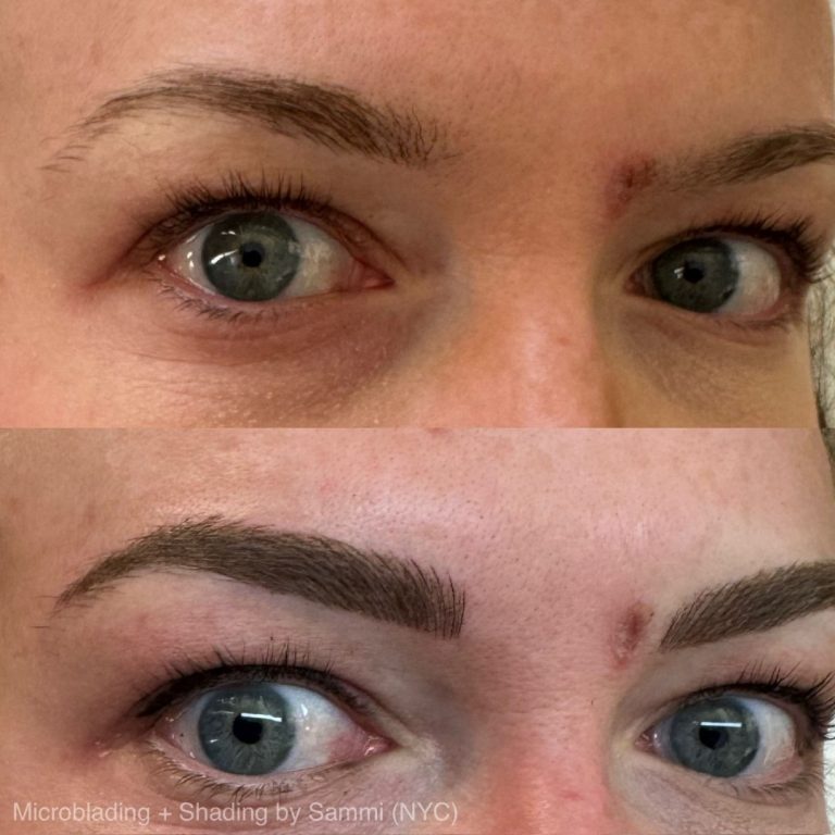 Close-up comparison of a person's eyebrows before (top) and after (bottom) microblading and shading treatment, showing fuller and more defined brows in the after image.