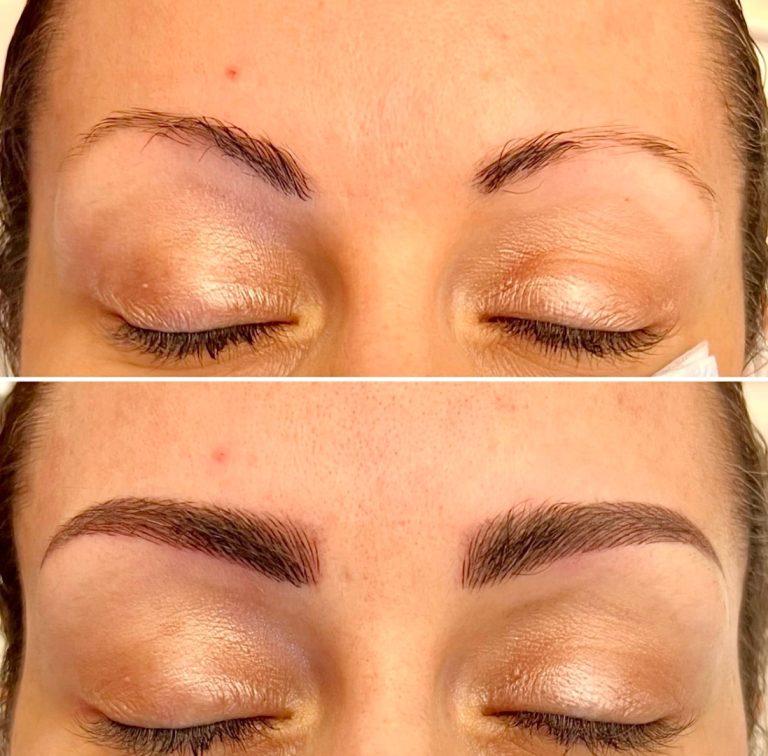 Close-up of a person's closed eyes showing their eyebrows before and after a cosmetic procedure, with the bottom image displaying fuller, more defined brows.