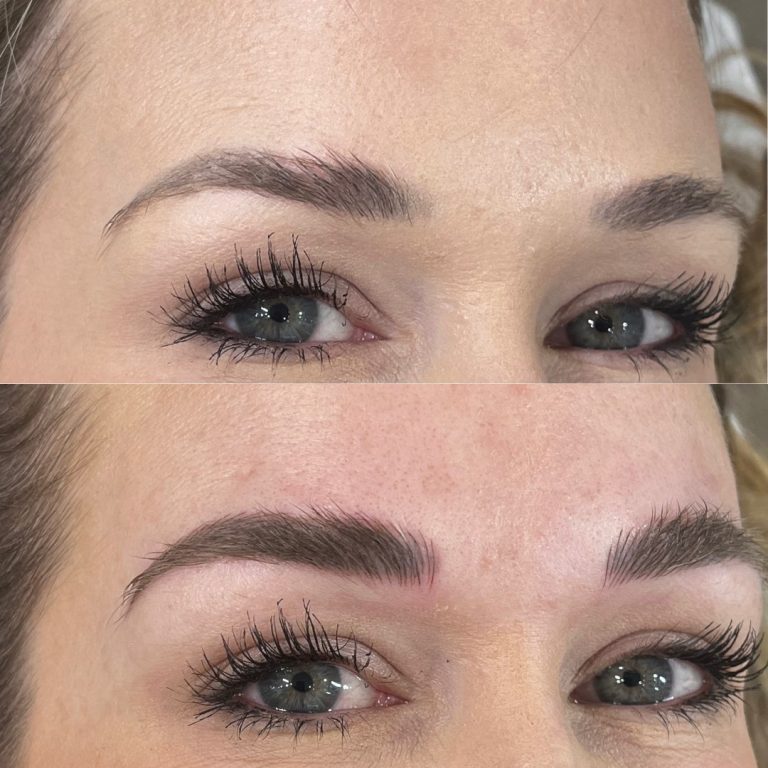 Close-up comparison of a woman's eyebrows before (top) and after (bottom) an eyebrow enhancement procedure, showing increased fullness and definition in the after image.