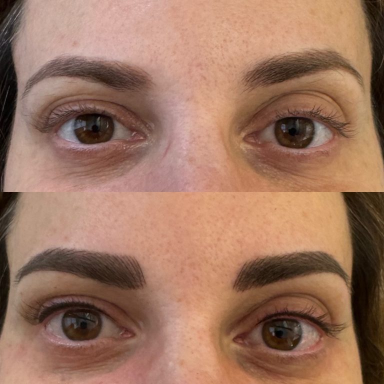 Close-up of a person's eyes showing eyebrows before (thin, sparse) and after (thicker, fuller) a cosmetic eyebrow enhancement procedure.