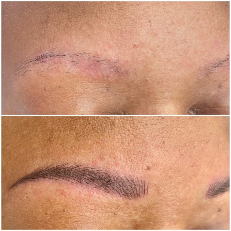 Before and after images of an eyebrow transformation; the top shows sparse brows, and the bottom shows fuller, shaped eyebrows, likely from a cosmetic procedure.