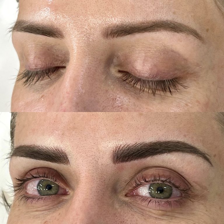 Close-up of a person's eyebrows and eyes, shown before (top, with eyes closed) and after (bottom, with eyes open) eyebrow enhancement procedure.