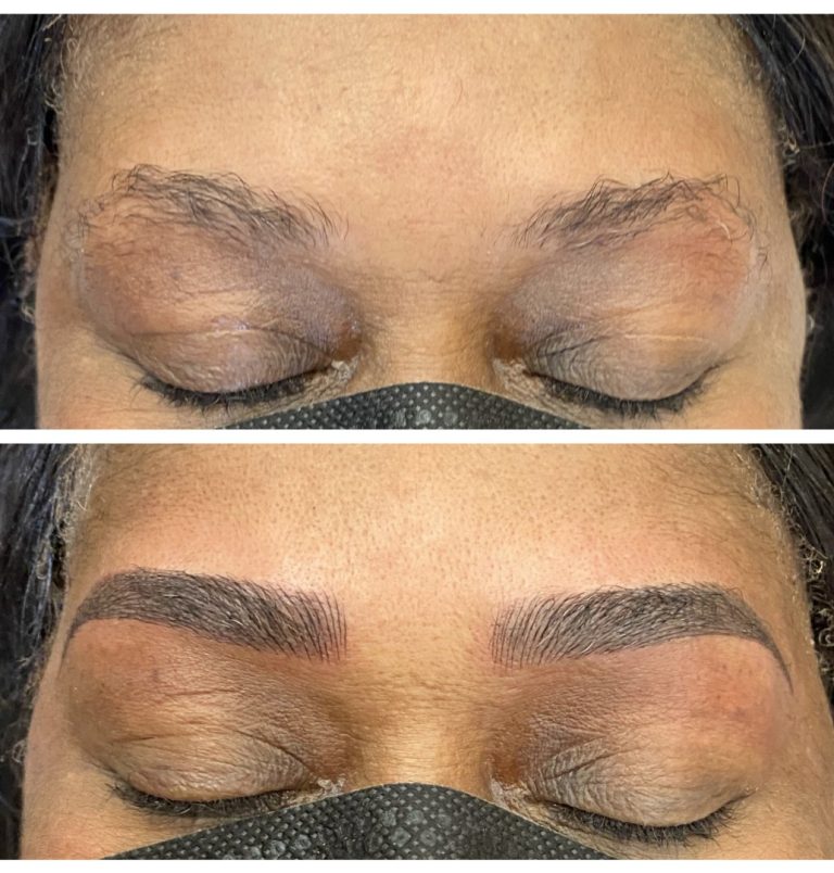 Close-up of a person's closed eyes showing sparse eyebrows in the top image and fuller, well-defined eyebrows in the bottom image after cosmetic enhancement.