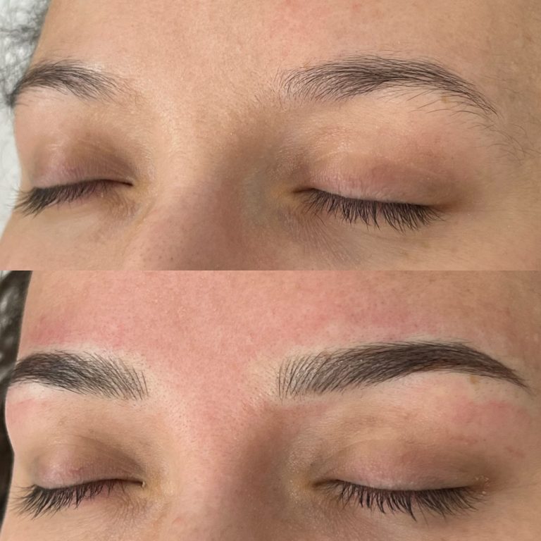 Close-up of closed eyes showing eyebrows before (top, sparse) and after (bottom, fuller and defined) eyebrow enhancement treatment.
