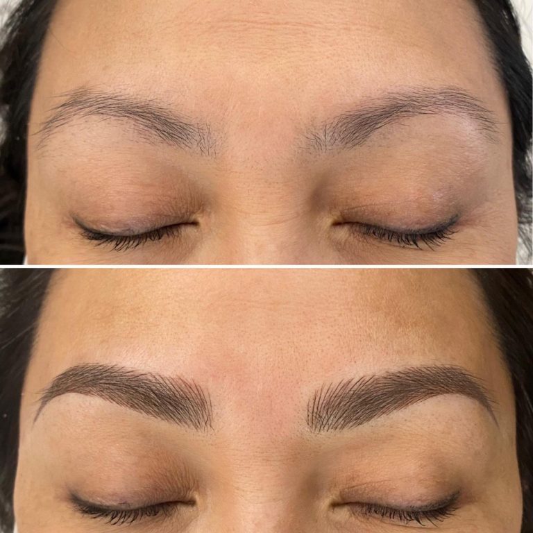 A before-and-after comparison shows eyebrows with sparse hair above and fuller, well-defined eyebrows below, both with eyes closed.