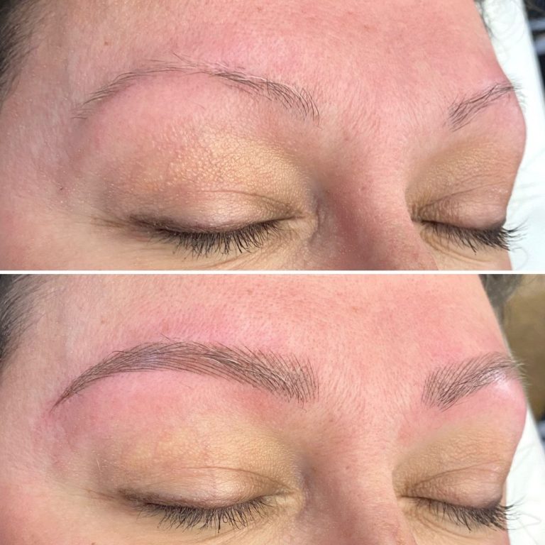 Before and after photos show a person's eyebrows: sparse and thin in the top image, fuller and defined after cosmetic enhancement in the bottom image.