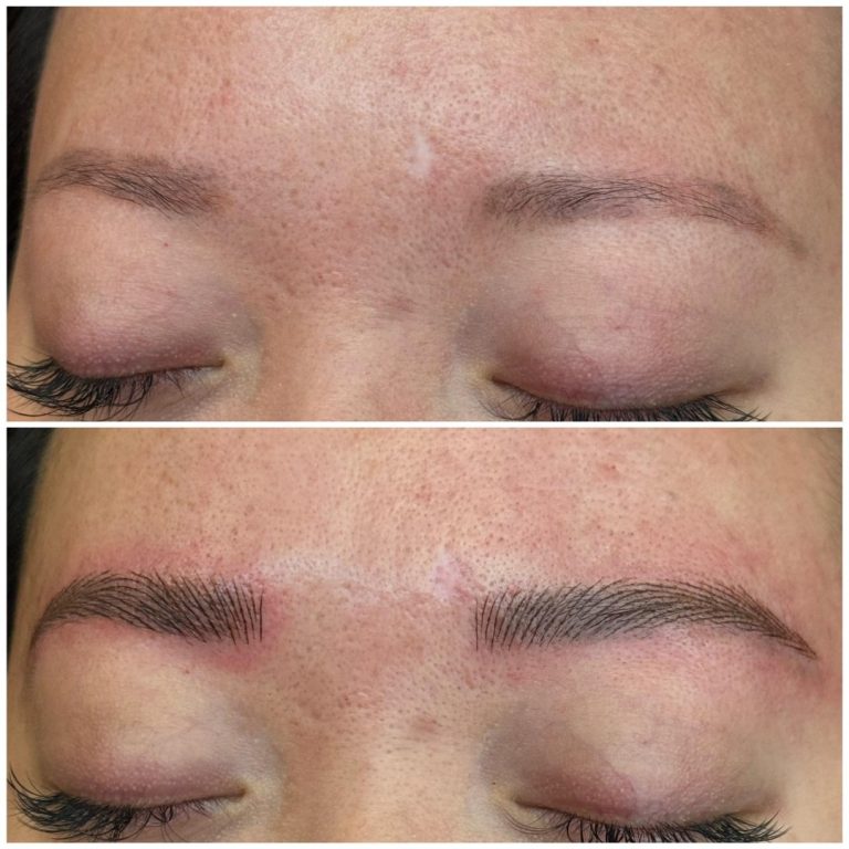Close-up of a person's eyebrows before and after microblading; the top shows sparse brows, while the bottom shows fuller, defined brows with visible hair-like strokes.