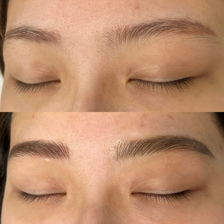 Close-up of closed eyes showing eyebrows before (top, thinner) and after (bottom, fuller and more defined) an eyebrow enhancement treatment.