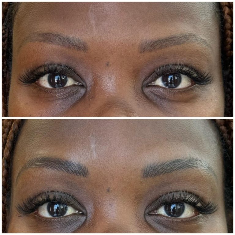 Close-up of a person's eyes showing their eyebrows before (top) and after (bottom) eyebrow microblading, with the lower image displaying fuller, more defined brows.