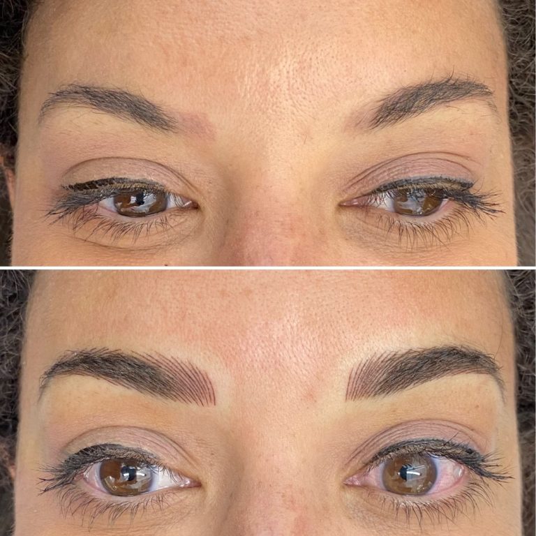 Close-up comparison of a person’s eyes before (top) and after (bottom) eyebrow microblading, showing fuller and more defined eyebrows in the after image.