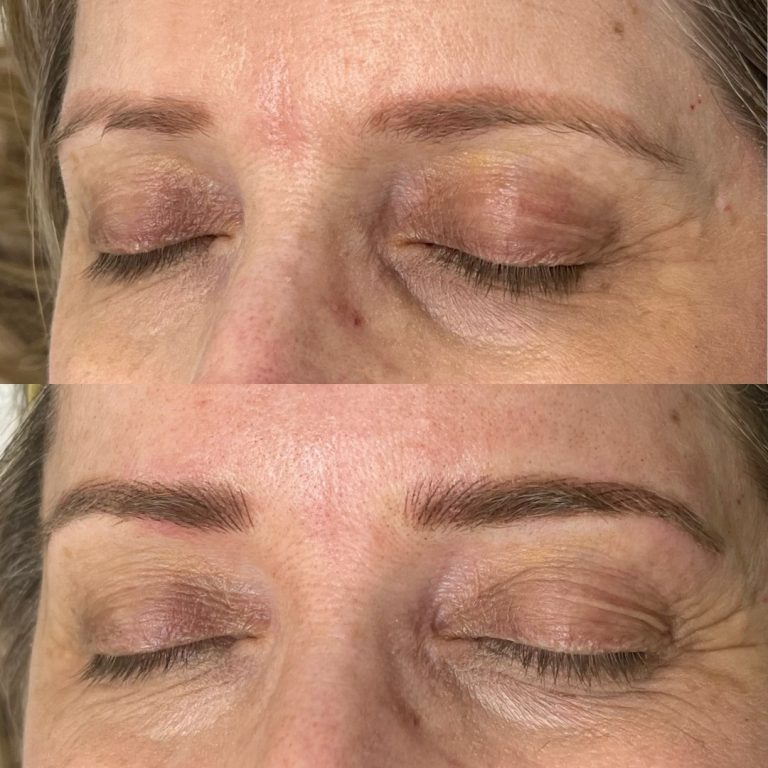 Close-up comparison of a person's closed eyes, showing sparse eyebrows in the top image and fuller, defined eyebrows in the bottom image after cosmetic enhancement.