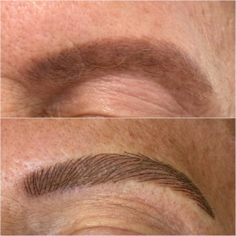 Close-up of an eyebrow before (top, faded and solid) and after (bottom, defined with hair-like strokes) a microblading treatment on light skin.