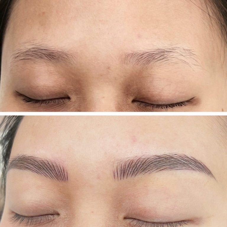 A before-and-after comparison showing sparse eyebrows above and fuller, defined eyebrows below, likely following a cosmetic enhancement procedure.