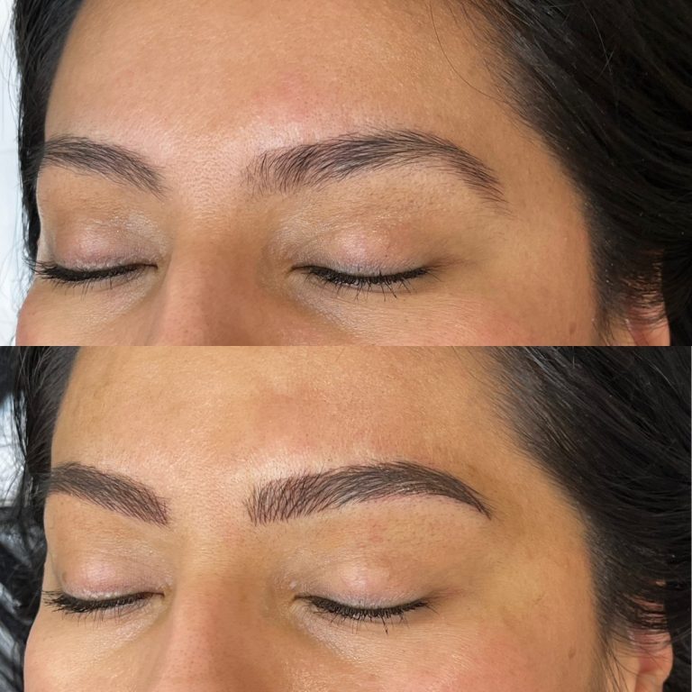 Close-up of a person's face showing eyebrows before (top) and after (bottom) a cosmetic procedure, with the after image displaying fuller, more defined eyebrows.