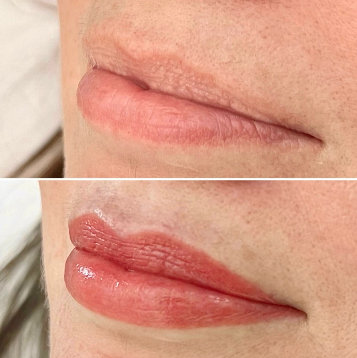 Two close-up images of lips: the top shows natural, pale lips, while the bottom shows the same lips with a fuller appearance and a glossy, reddish tint.