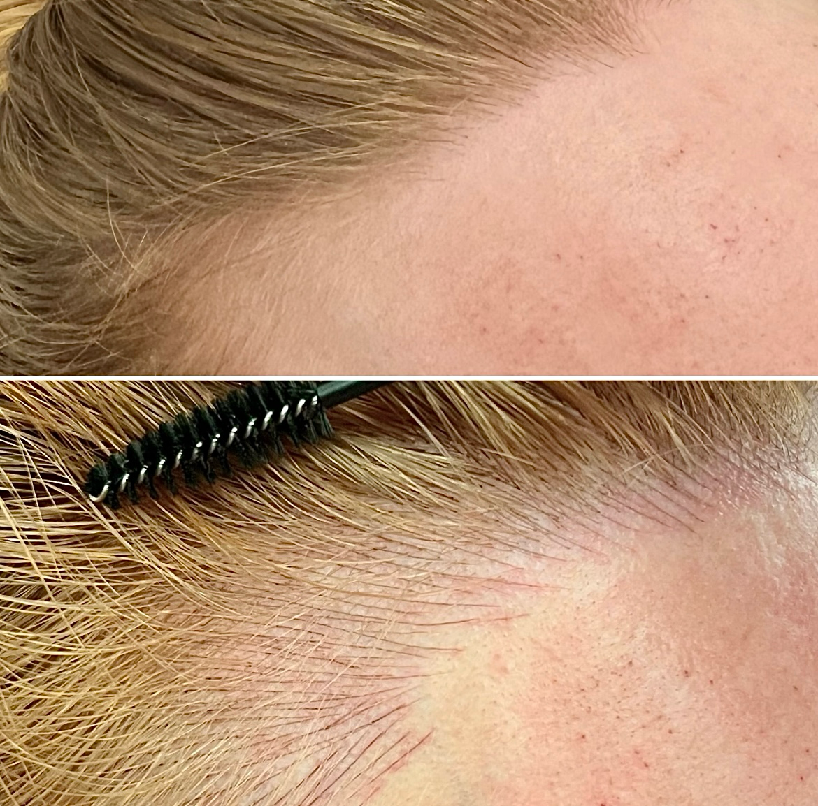 Two close-up images show a person's hairline; the top image is before, and the bottom image is after applying a product to fill in and define the hairline with a brush.