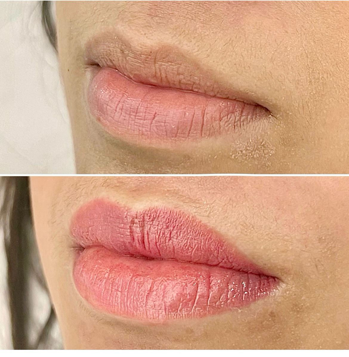 Close-up of lips before and after a cosmetic procedure; the first image shows natural lips, the second shows fuller and more defined lips.