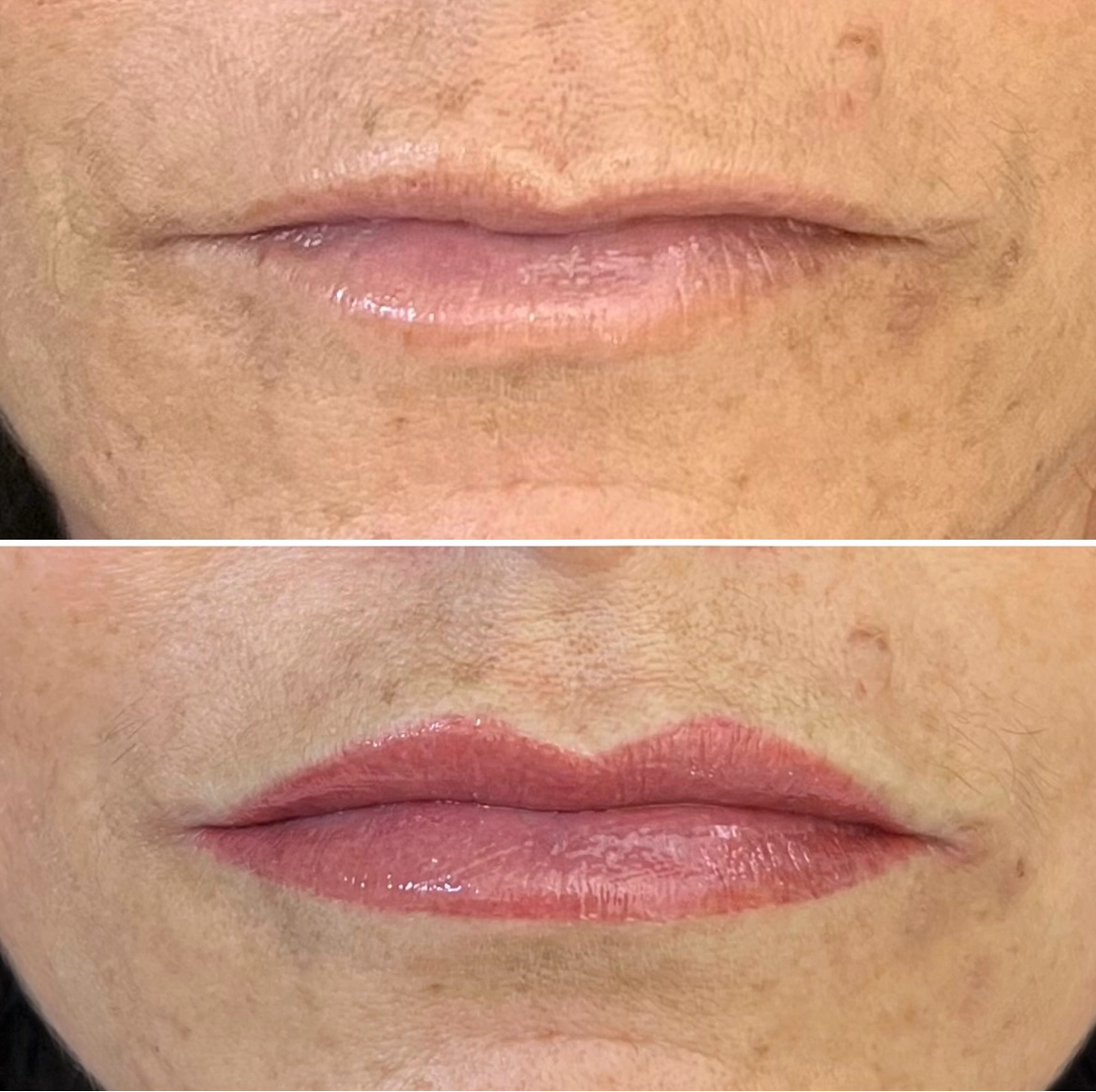 Close-up comparison of lips before (top) and after (bottom) cosmetic treatment, showing increased definition and enhanced color in the lower image.