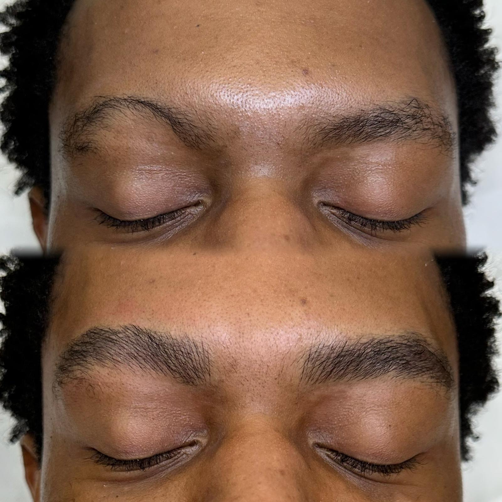 Close-up of a person's face showing before and after images of eyebrows; the top image shows sparse brows, while the bottom highlights fuller, groomed results achieved with microblading or nanobrows.