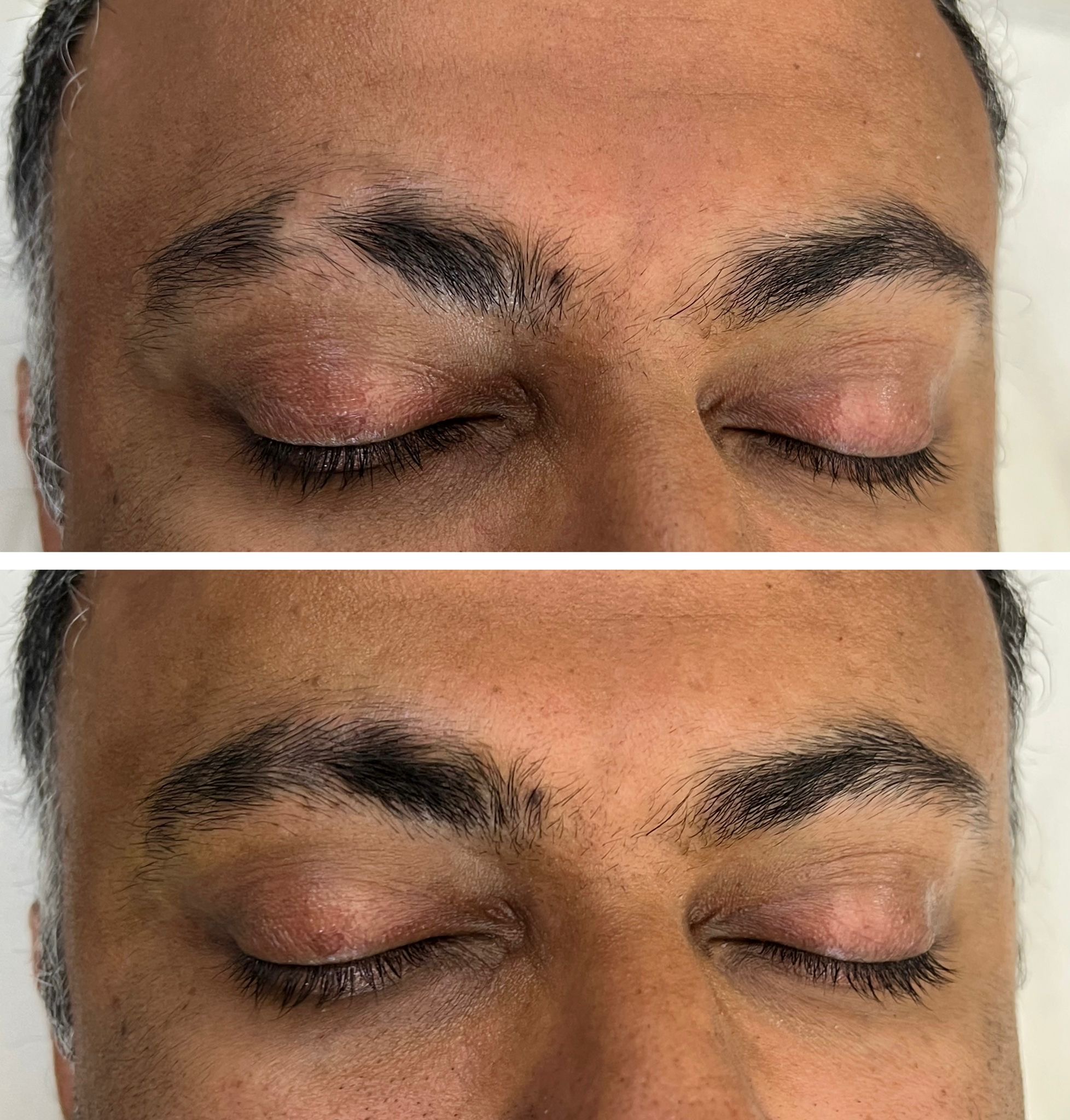 Close-up of a person's closed eyes, featuring sparse eyebrows in the top image and fuller, more even eyebrows in the bottom image after microblading or nanobrows.