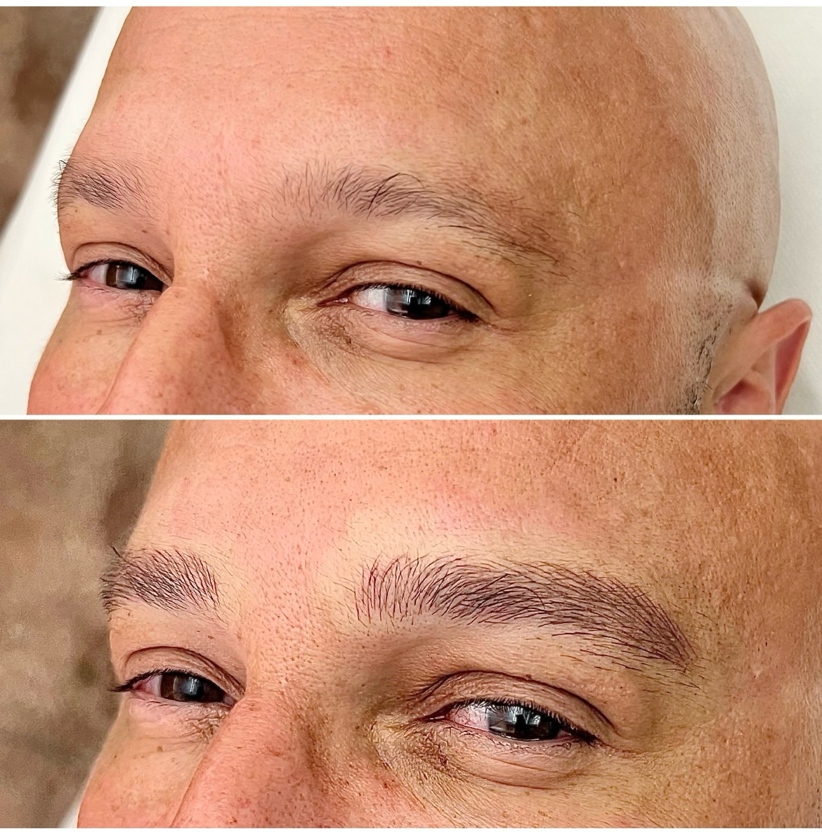 A close-up comparison shows a person's eyebrow area before (top, sparse brows) and after (bottom, fuller brows) an eyebrow enhancement procedure using microblading and nanobrows techniques.