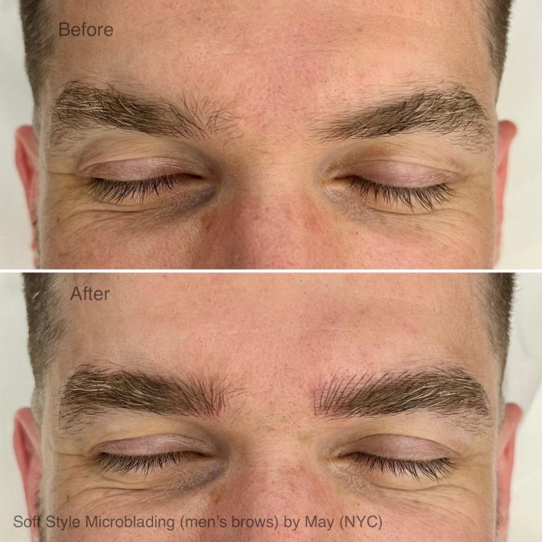 Close-up of a man's closed eyes highlighting eyebrows before and after microblading and nanobrows; the after image reveals fuller, more defined brows.