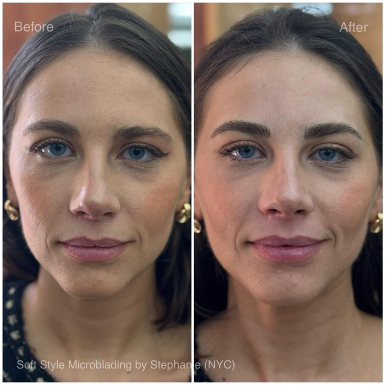 Side-by-side comparison of a woman’s face before and after eyebrow microblading and nanobrows, showing fuller and more defined eyebrows in the "after" image.