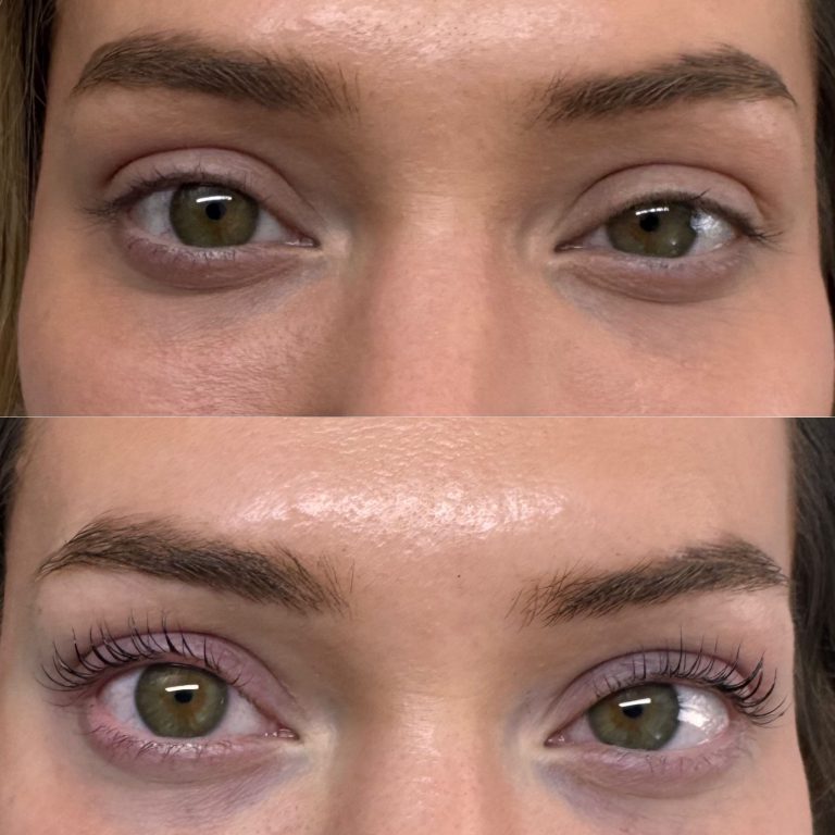 Close-up comparison of a person's eyes before (top) and after (bottom) a Lash Lift, highlighting the dramatic lift and curl of the eyelashes in the bottom image.