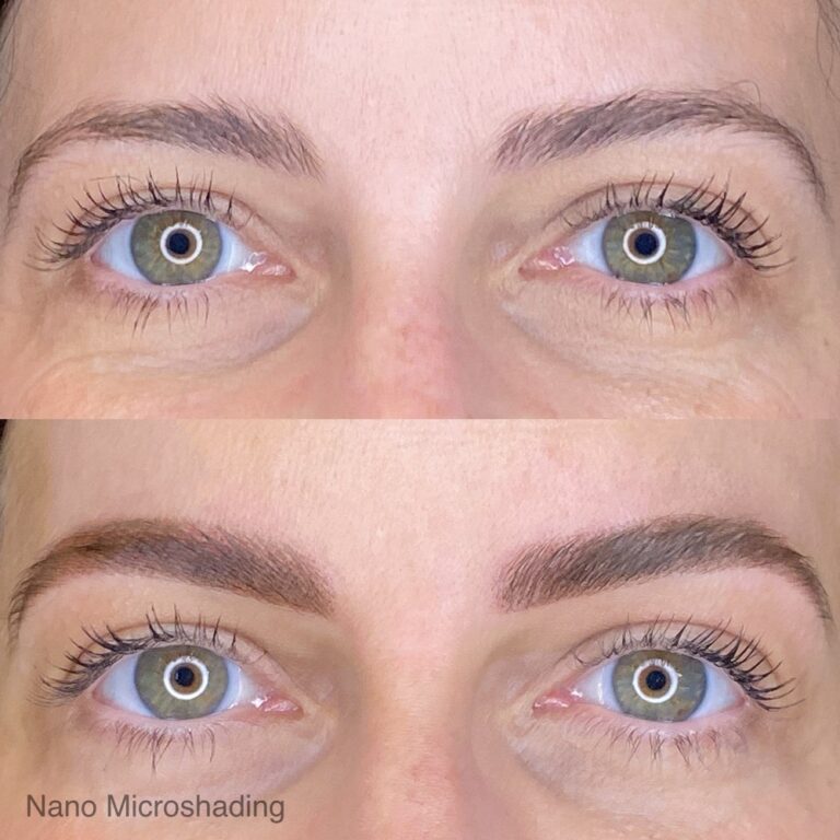 Close-up of a person's eyes showing eyebrows before (top) and after (bottom) nano microshading, with fuller and more defined brows in the after image.