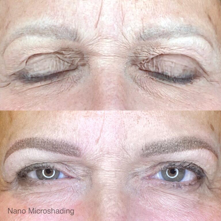 Close-up of a person's eyes showing a before and after comparison of nano microshading eyebrow treatment; top shows sparse brows, bottom shows fuller, defined brows.
