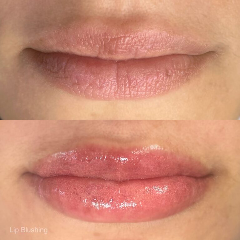 Close-up of lips before and after lip blushing treatment; top image shows natural lips, bottom image shows enhanced color and gloss.