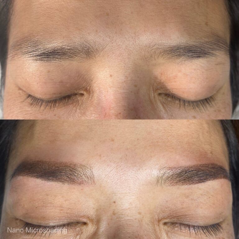 Close-up of closed eyes showing a comparison of eyebrows before and after nano microshading; the top image shows sparse brows, and the bottom shows fuller, defined brows.