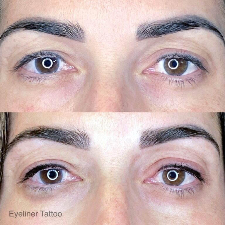 Close-up of two pairs of eyes, shown before (top) and after (bottom) getting an eyeliner tattoo. The bottom image shows defined eyeliner along the upper eyelids.